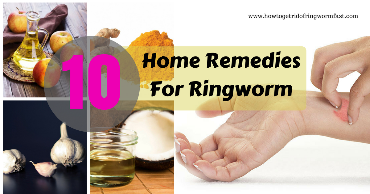 home remedies 10 home remedies for remedies