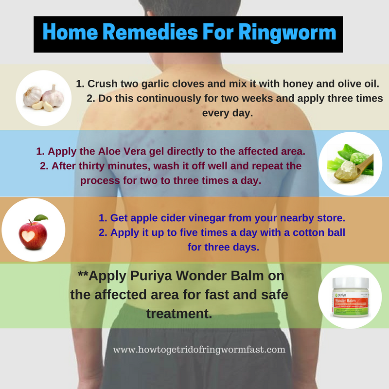 Home Remedies For Ringworm