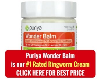 Get Rid Of Ringworm Fast Naturally Get Rid Of Ringworm Fast Naturally