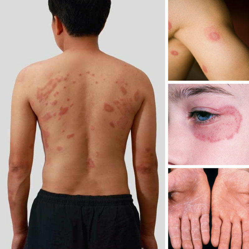 symptoms look at these symptoms